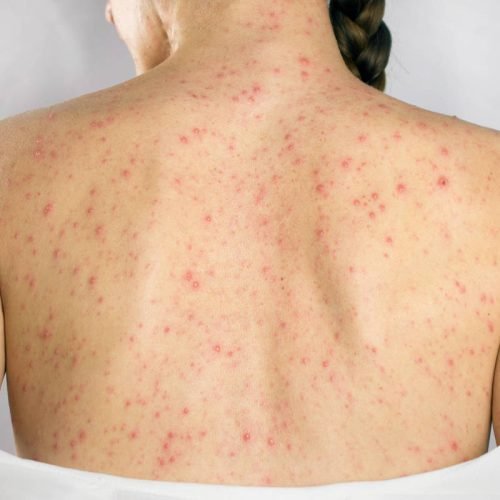 SecondSide/Adobe Stock