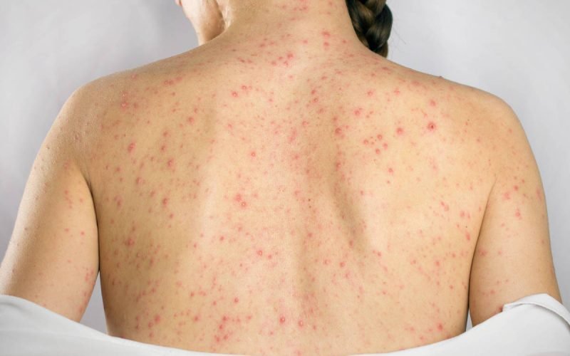 SecondSide/Adobe Stock